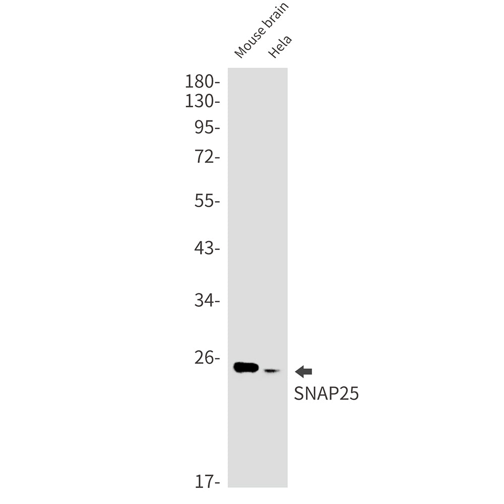 SNAP25 Rabbit Monoclonal Antibody