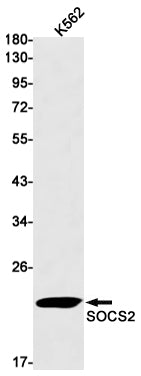 SOCS2 Rabbit Monoclonal Antibody