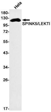 SPINK5 Rabbit Monoclonal Antibody