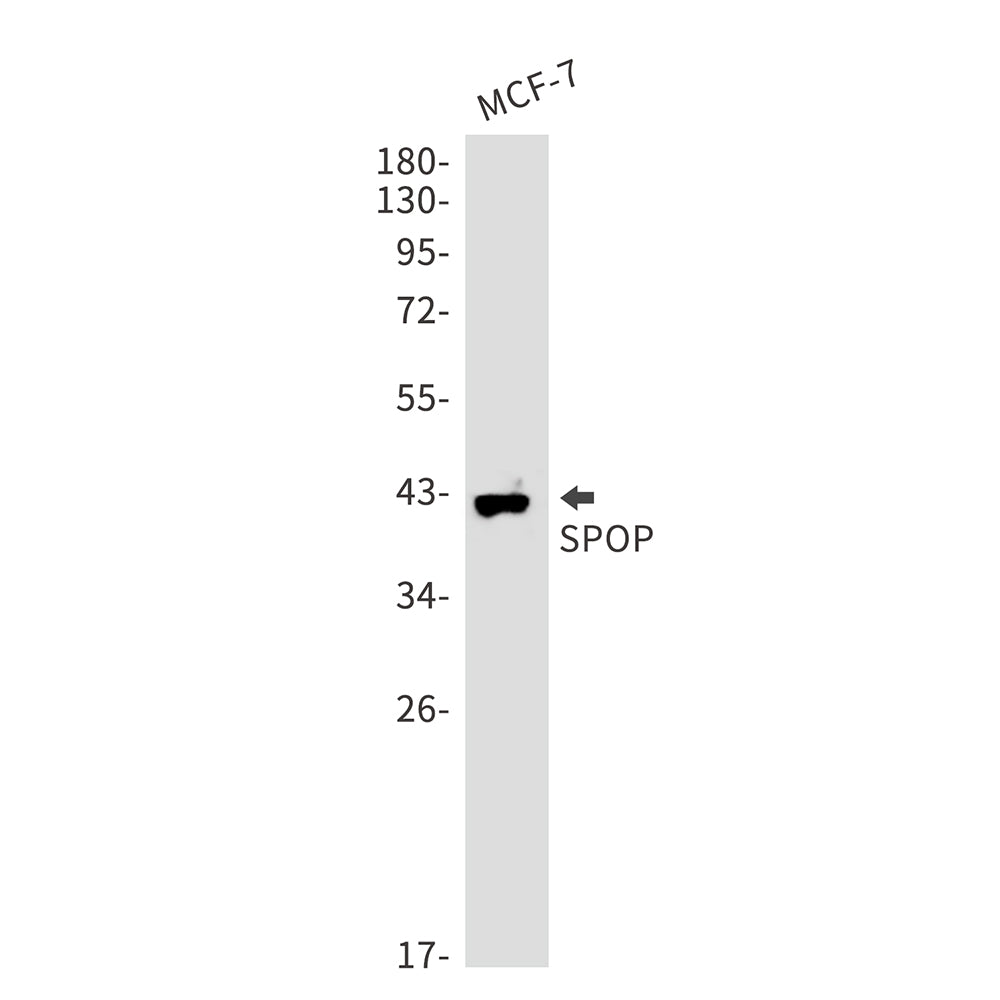 SPOP Rabbit Monoclonal Antibody