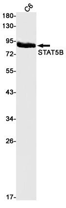 STAT5b Rabbit Monoclonal Antibody