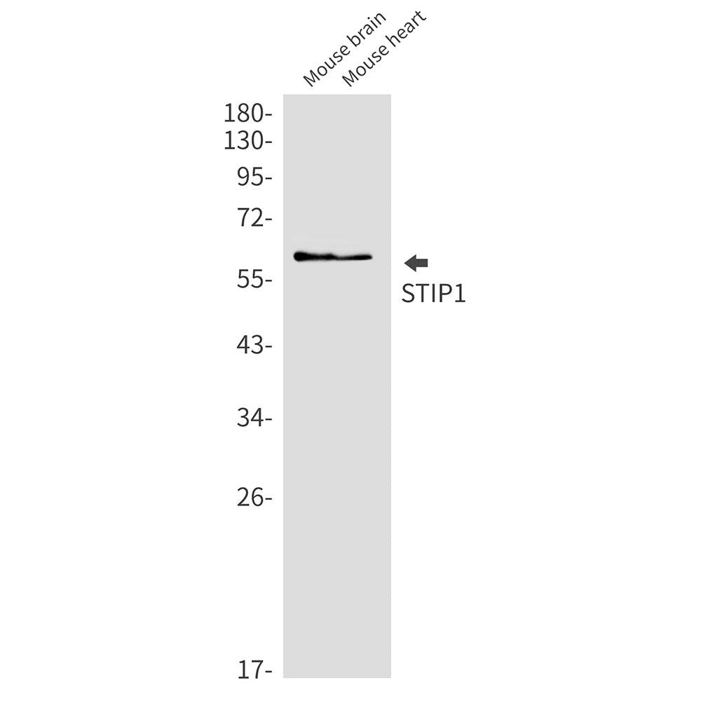 STIP1 Rabbit Monoclonal Antibody