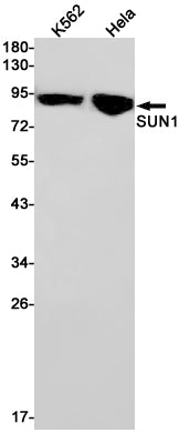 SUN1 Rabbit Monoclonal Antibody