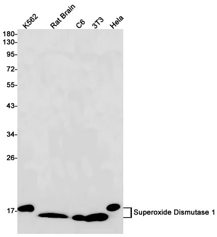 Superoxide Dismutase 1 Rabbit Monoclonal Antibody