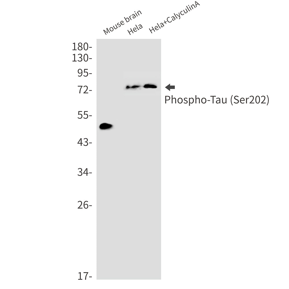 Phospho-Tau (Ser202) Rabbit Monoclonal Antibody