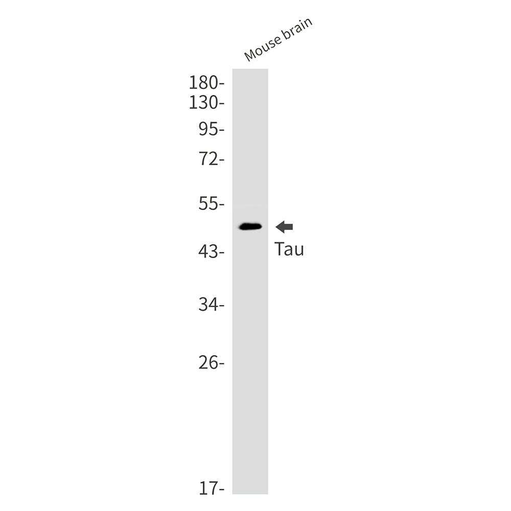 Tau Rabbit Monoclonal Antibody