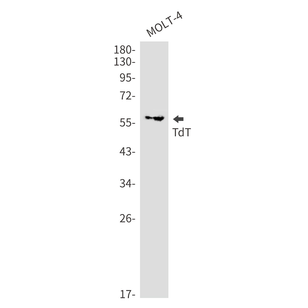 DNA Nucleotidylexotransferase Rabbit Monoclonal Antibody