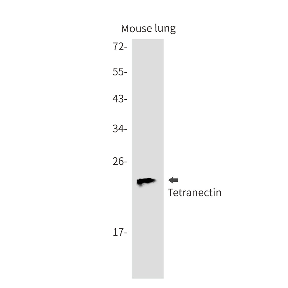 Tetranectin Rabbit Monoclonal Antibody