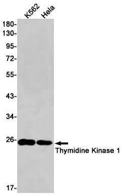 Thymidine Kinase Rabbit Monoclonal Antibody