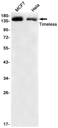 TIMELESS Rabbit Monoclonal Antibody