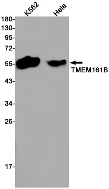 Transmembrane Protein 161B Rabbit Monoclonal Antibody