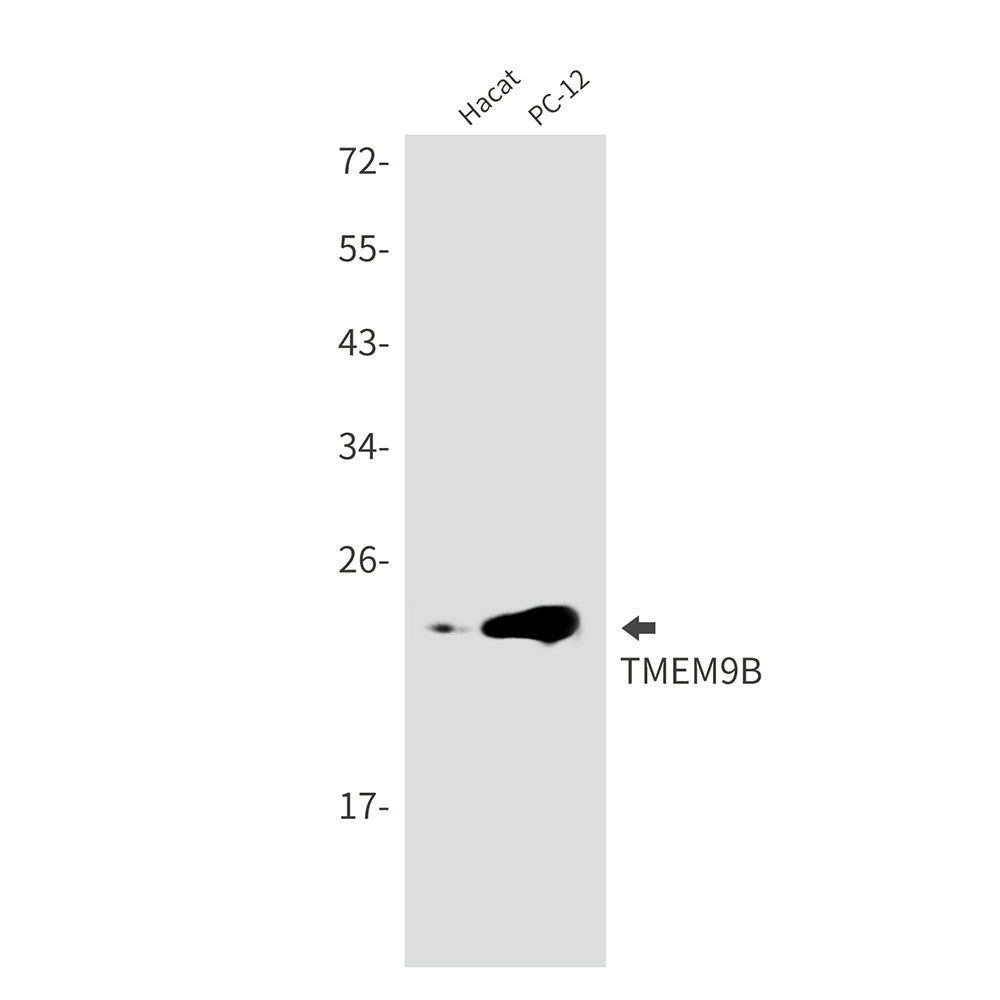Transmembrane Protein 9B Rabbit Monoclonal Antibody