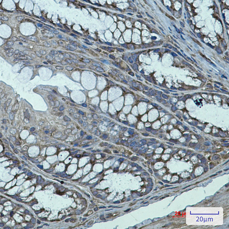 Transglutaminase 2 Rabbit Monoclonal Antibody