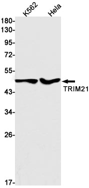 TRIM21 Rabbit Monoclonal Antibody