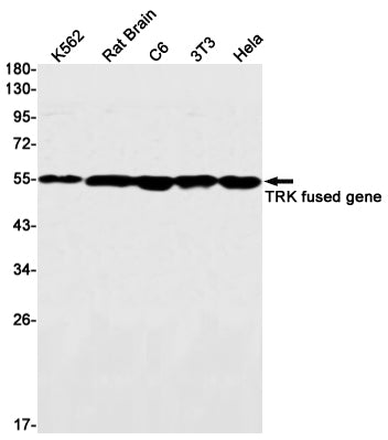 TFG Rabbit Monoclonal Antibody