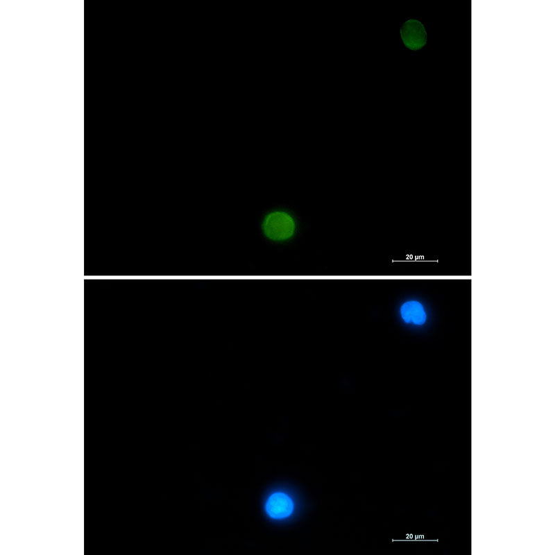 Ubiquitin Rabbit Monoclonal Antibody