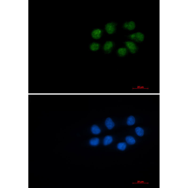 Phospho-Vimentin (Ser56) Rabbit Monoclonal Antibody