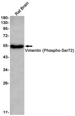 Phospho-Vimentin (Ser72) Rabbit Monoclonal Antibody