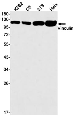 Vinculin Rabbit Monoclonal Antibody