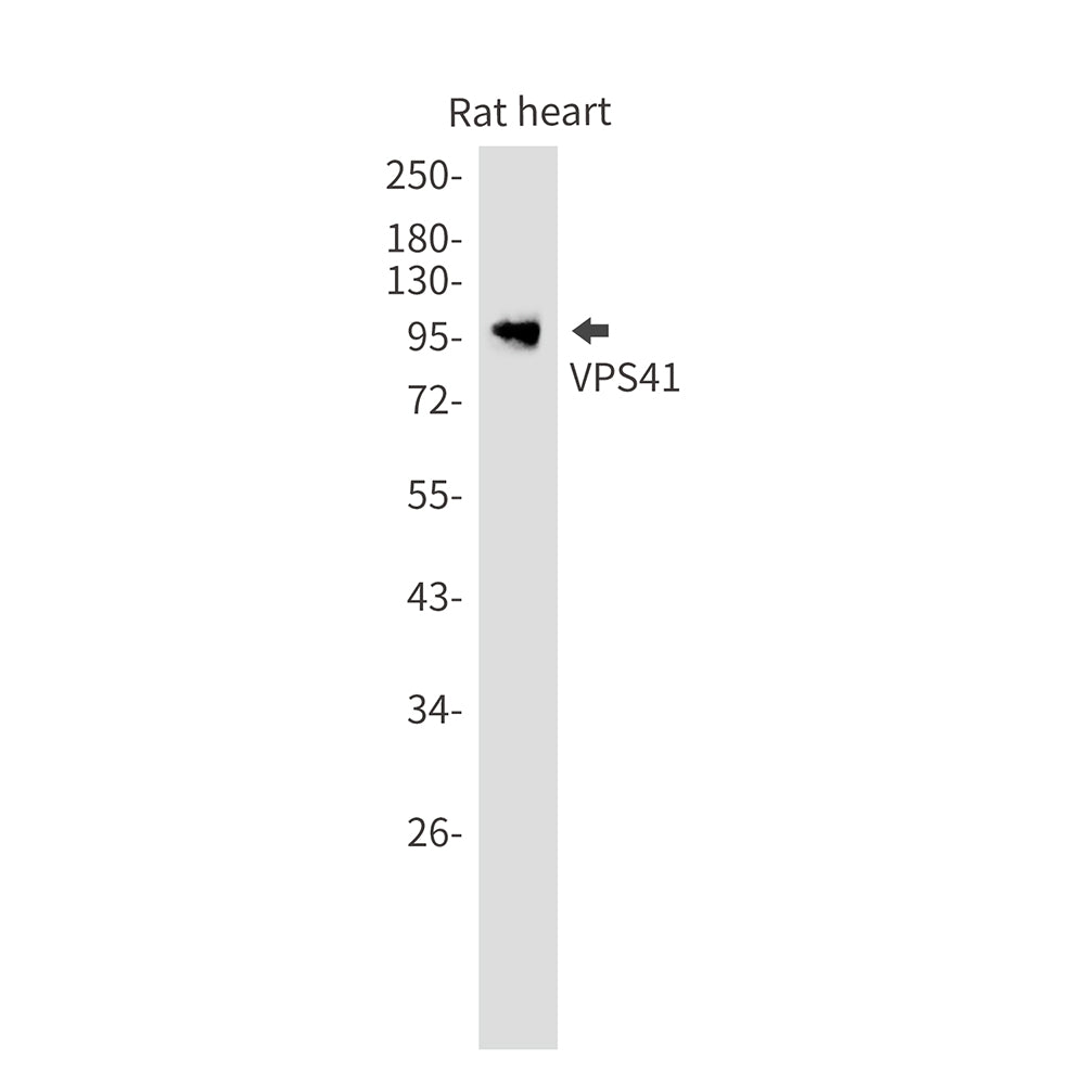 VPS41 Rabbit Monoclonal Antibody