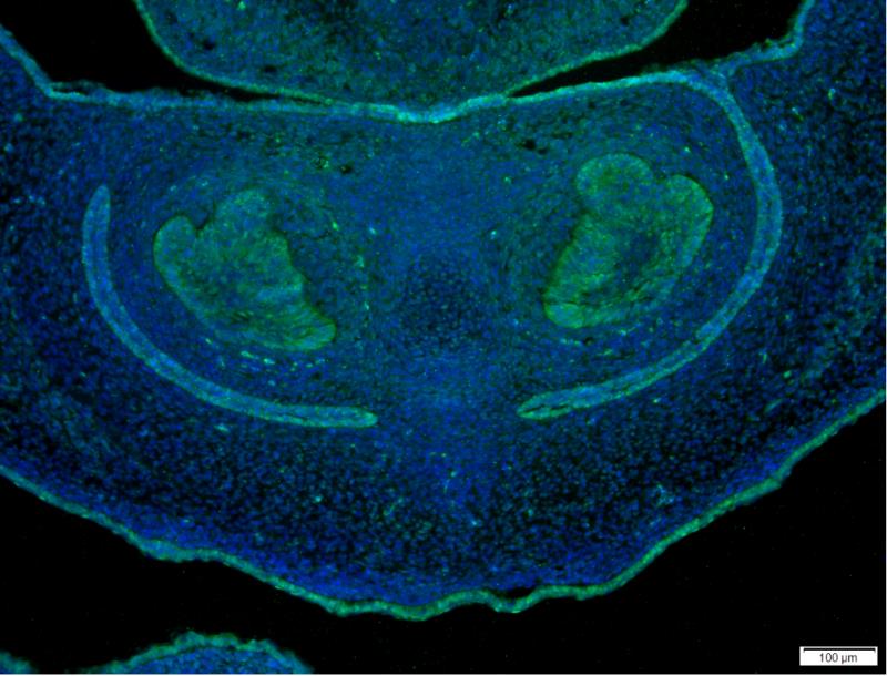 YAP1 Rabbit Monoclonal Antibody