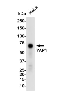 YAP1 Rabbit Monoclonal Antibody