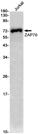 ZAP70 Rabbit Monoclonal Antibody