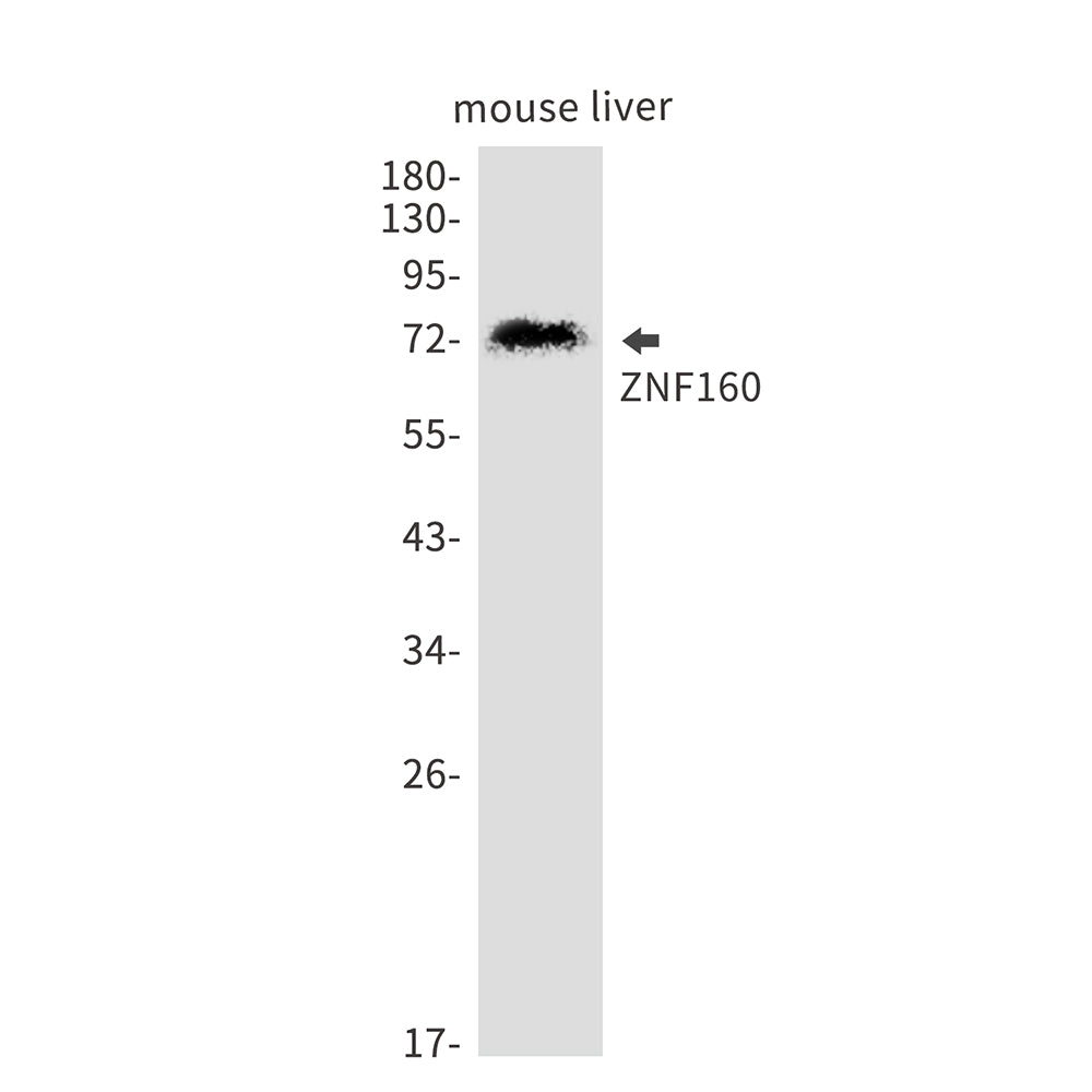 ZNF160 Rabbit Monoclonal Antibody