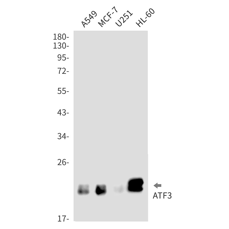 ATF3 Rabbit Monoclonal Antibody
