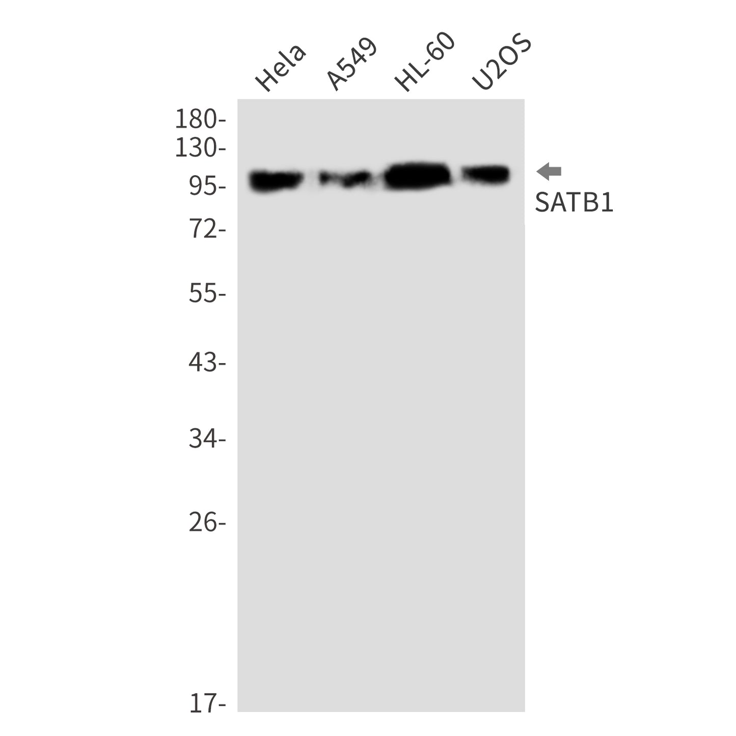 SATB1 Rabbit Monoclonal Antibody
