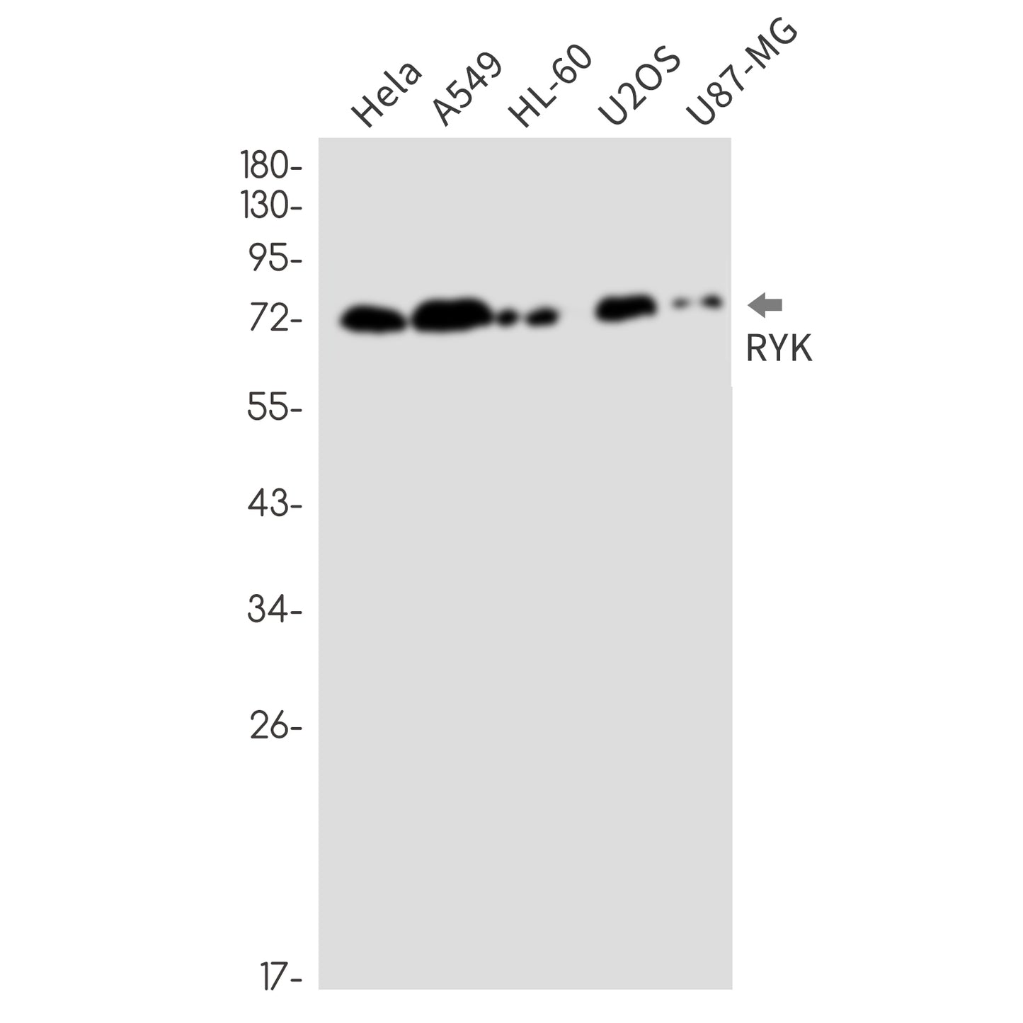 RYK Rabbit Monoclonal Antibody