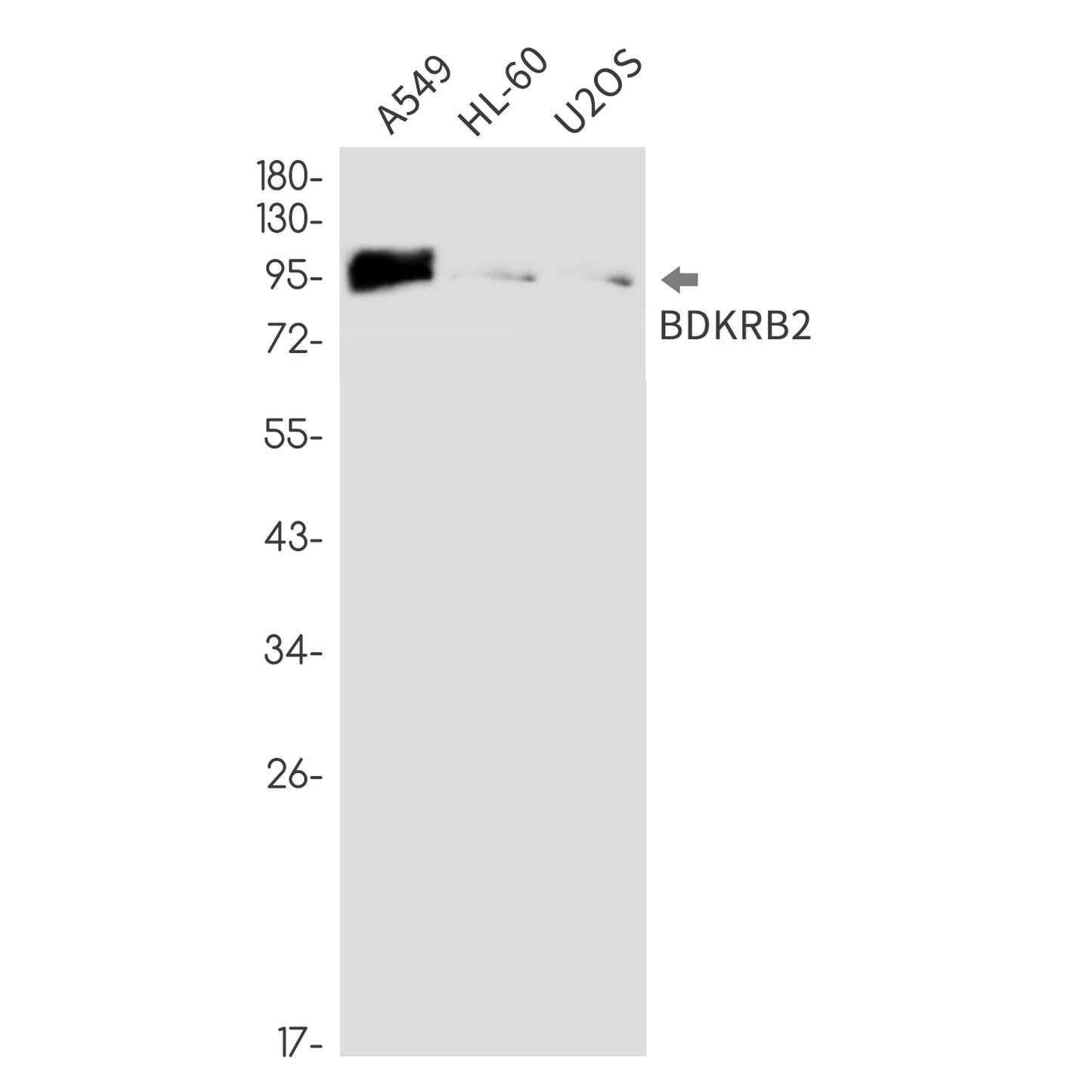 BDKRB2 Rabbit Monoclonal Antibody