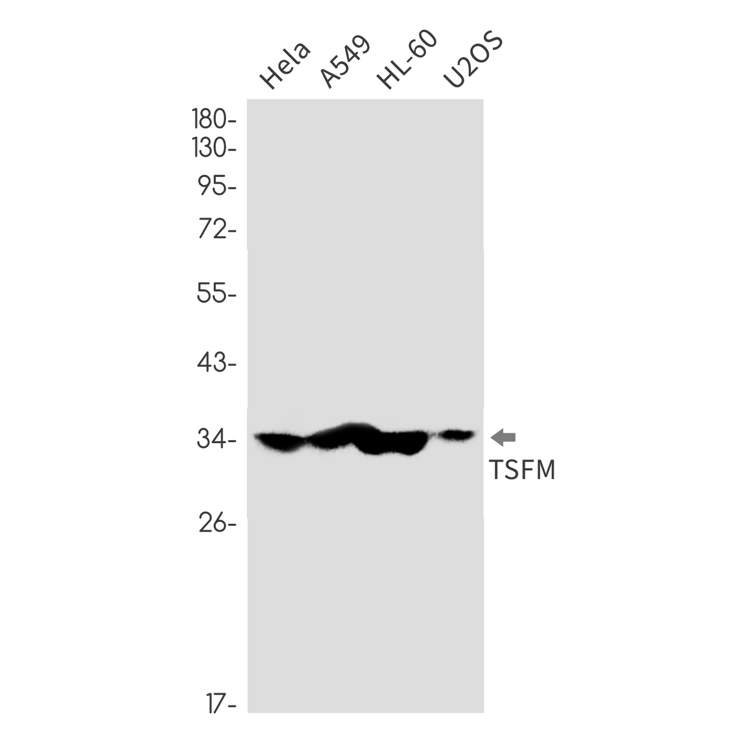 Elongation Factor Ts Rabbit Monoclonal Antibody