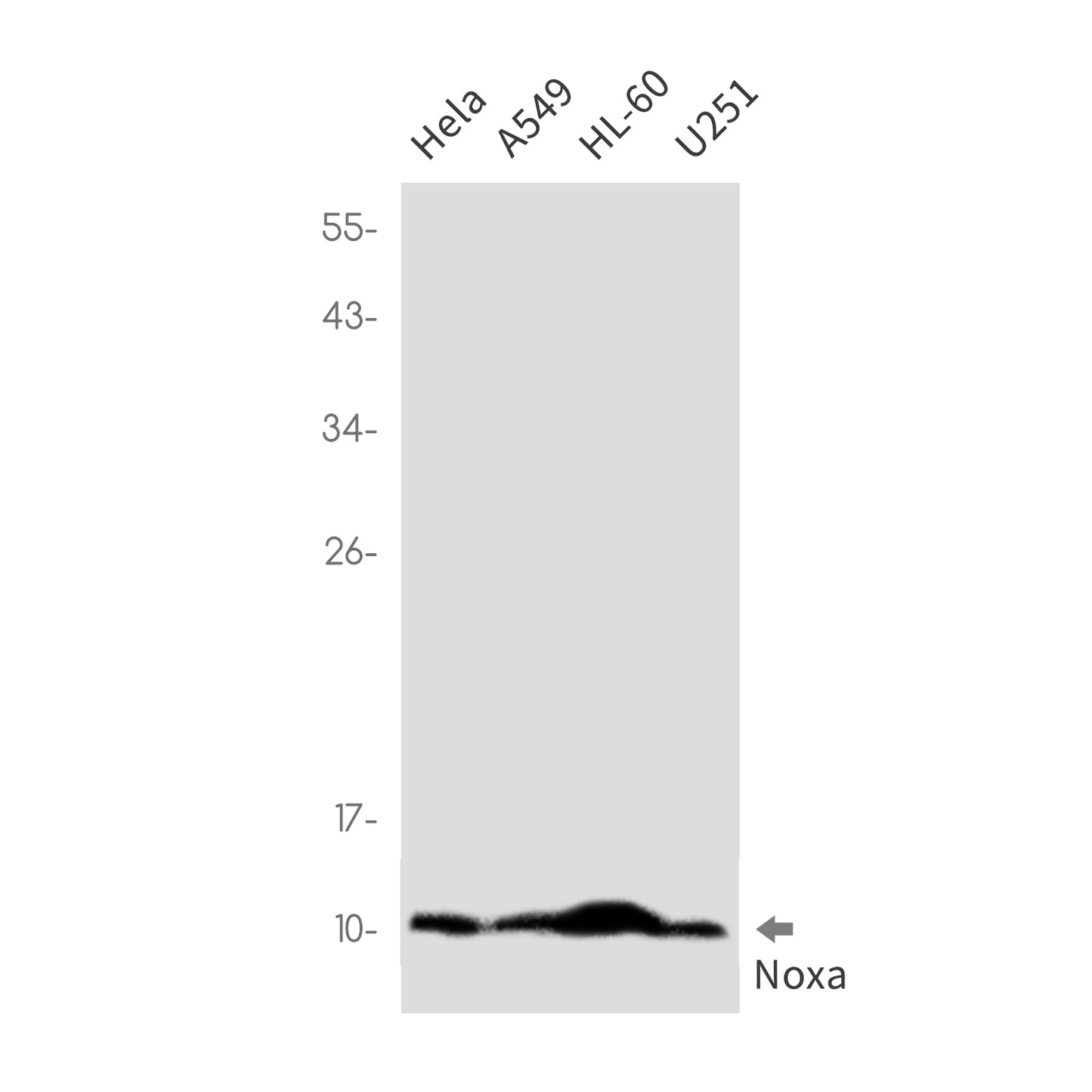 NOXA Rabbit Monoclonal Antibody