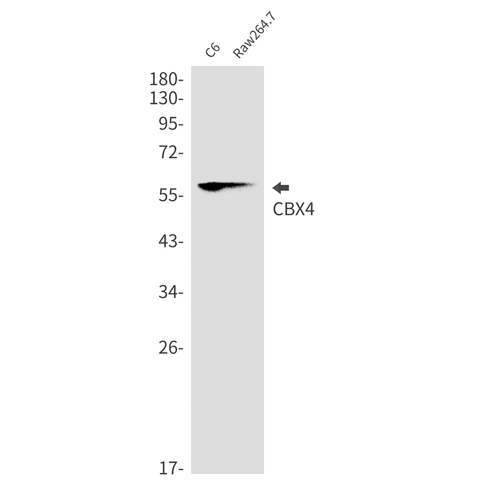 CBX4 Rabbit Monoclonal Antibody