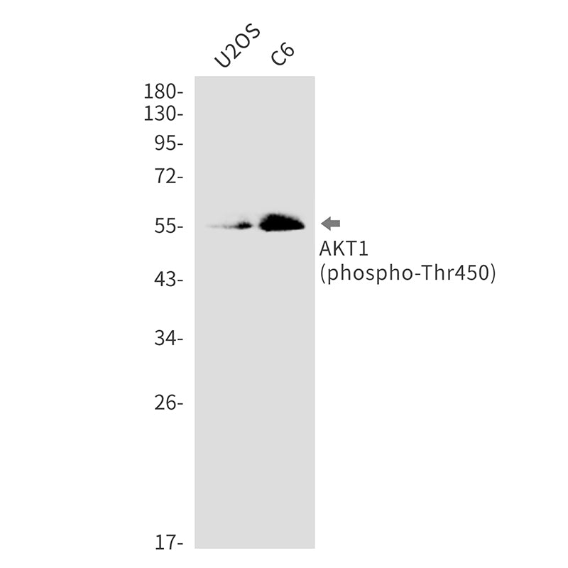 Phospho-AKT1 (Thr450) Rabbit Monoclonal Antibody