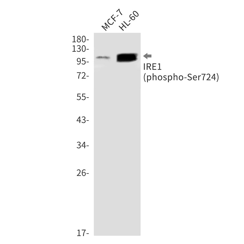Phospho-IRE1 (Ser724) Rabbit Monoclonal Antibody
