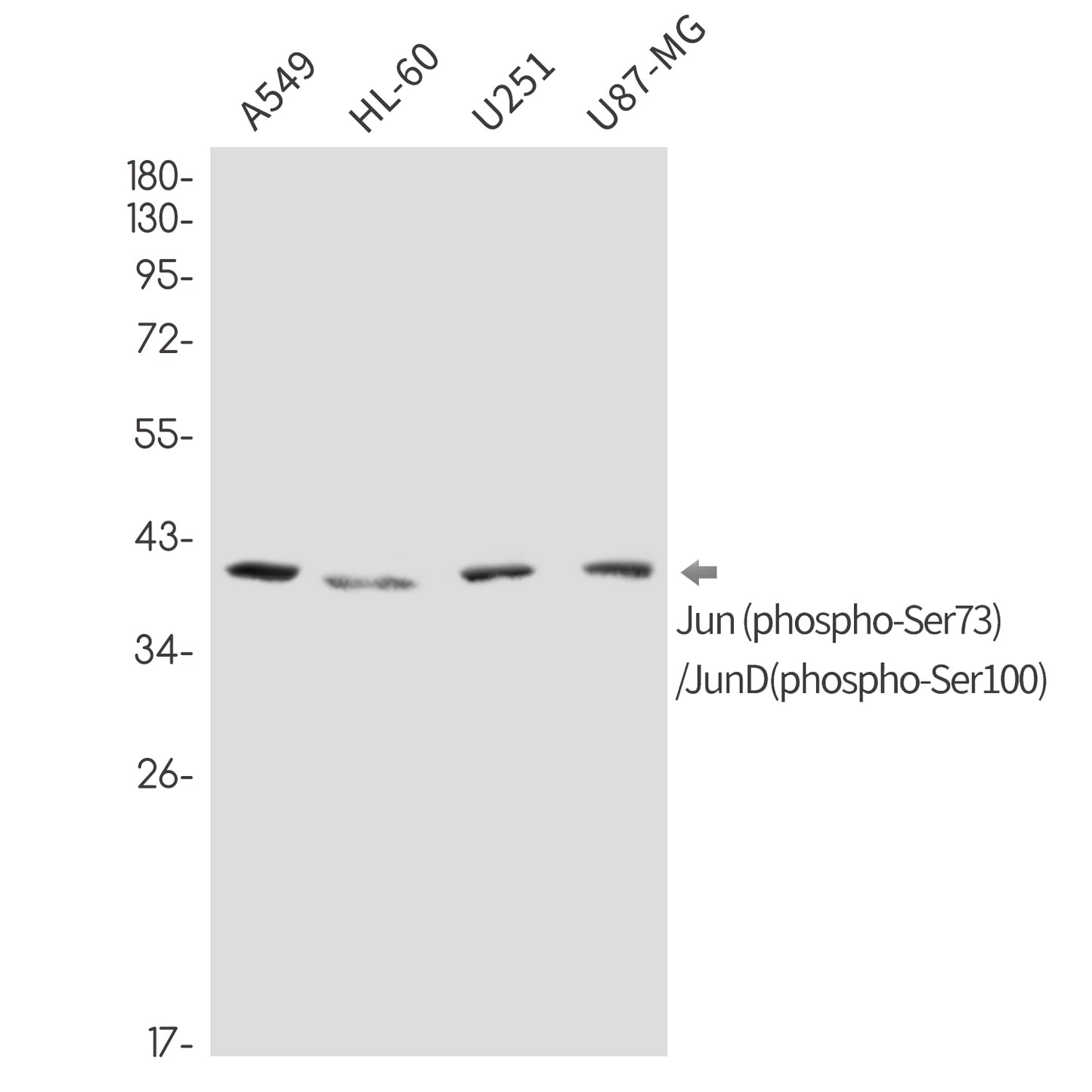 Phospho-Jun/JunD (Ser73/Ser100) Rabbit Monoclonal Antibody
