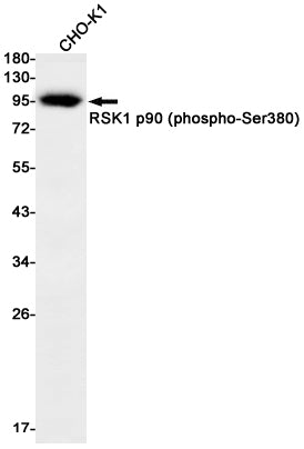Phospho-RSK1 p90 (Ser380) Rabbit Monoclonal Antibody