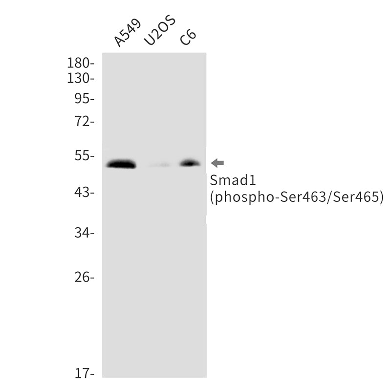 Phospho-Smad1 (Ser463/Ser465) Rabbit Monoclonal Antibody