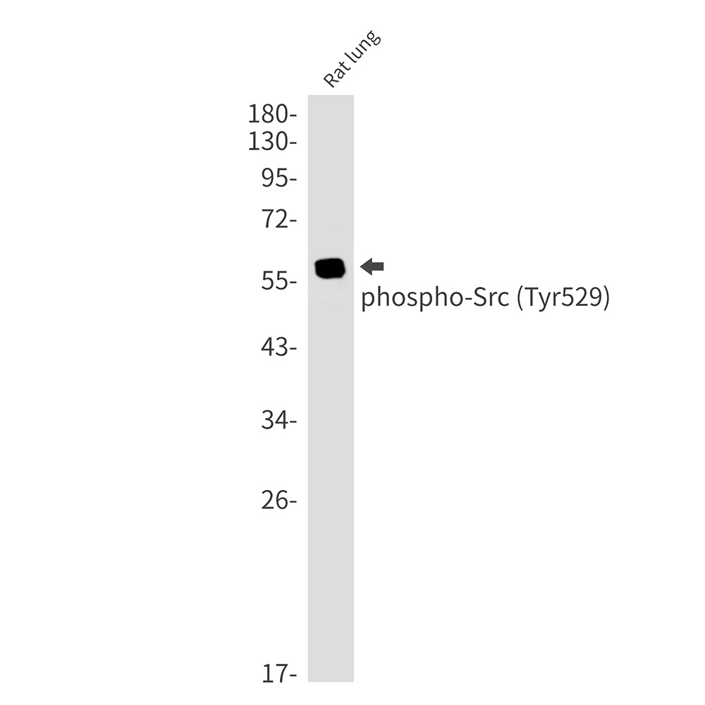 Phospho-Src (Tyr530) Rabbit Monoclonal Antibody
