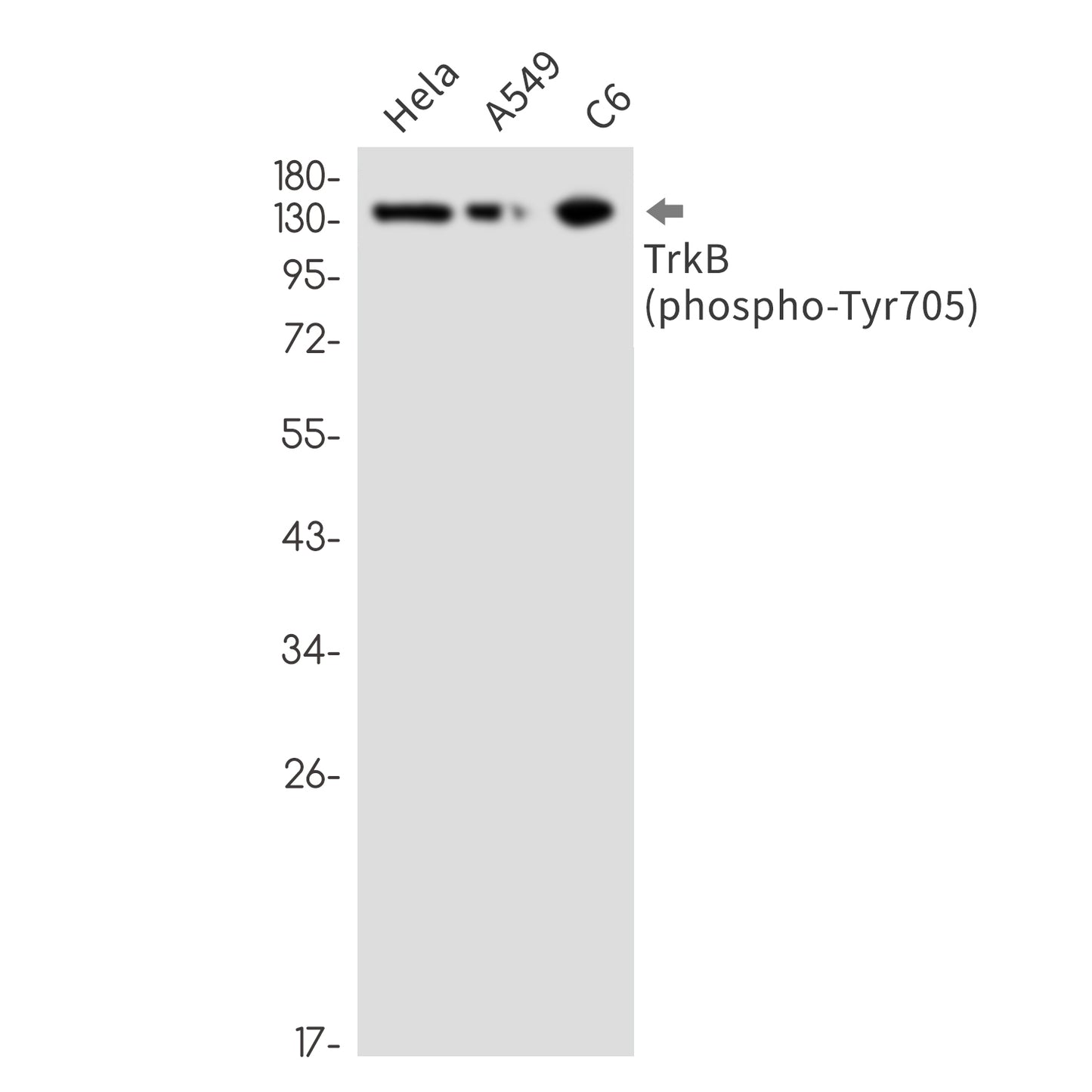 Phospho-TrkB (Tyr705) Rabbit Monoclonal Antibody