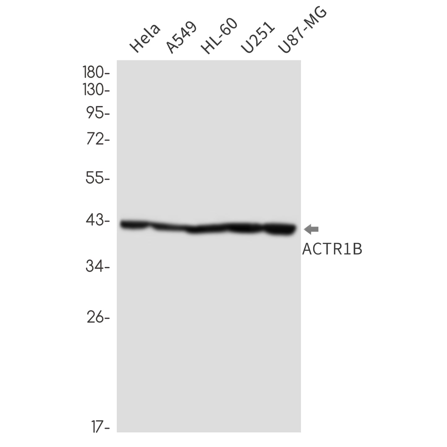 ACTR1B Rabbit Monoclonal Antibody