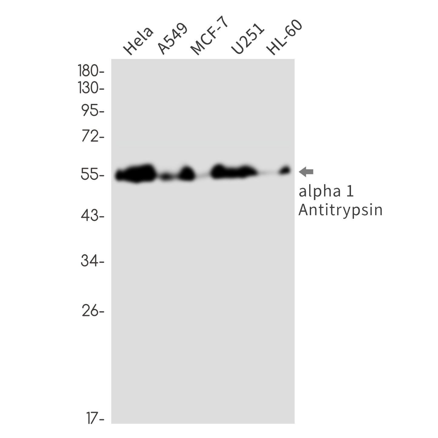 alpha 1-Antitrypsin Rabbit Monoclonal Antibody