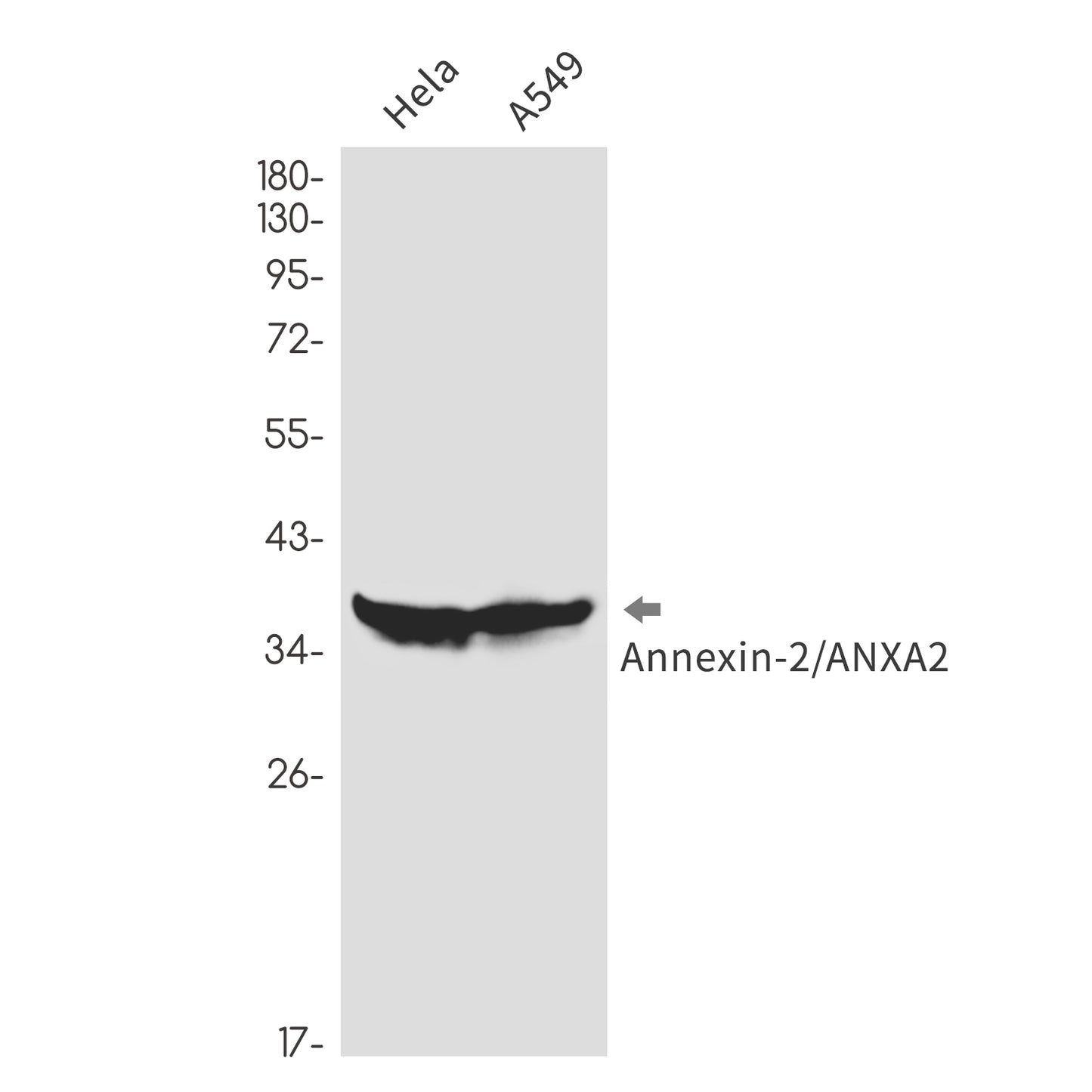 Annexin 2 Rabbit Monoclonal Antibody