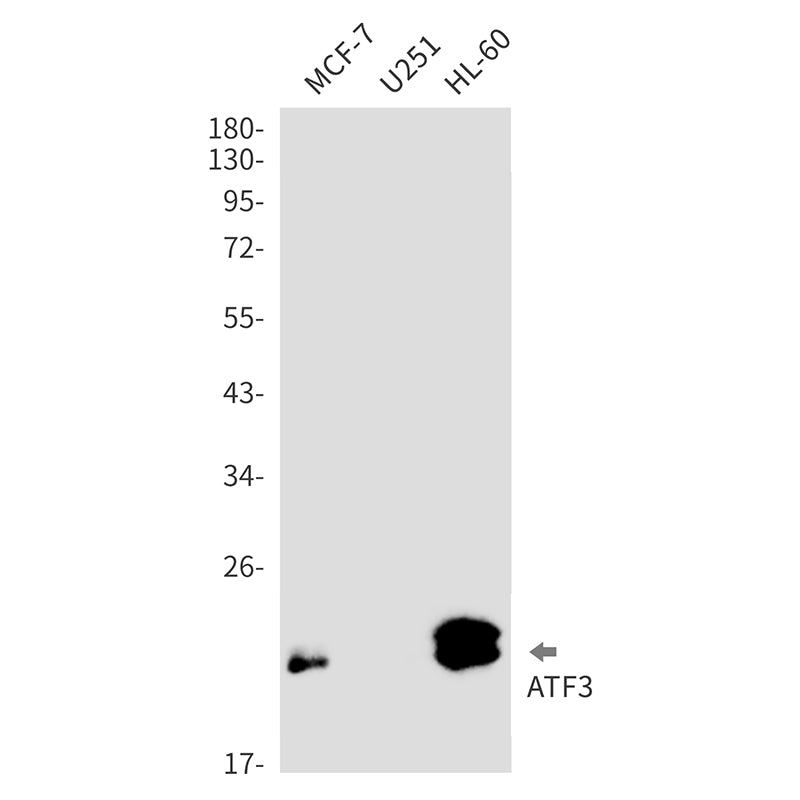 ATF3 Rabbit Monoclonal Antibody