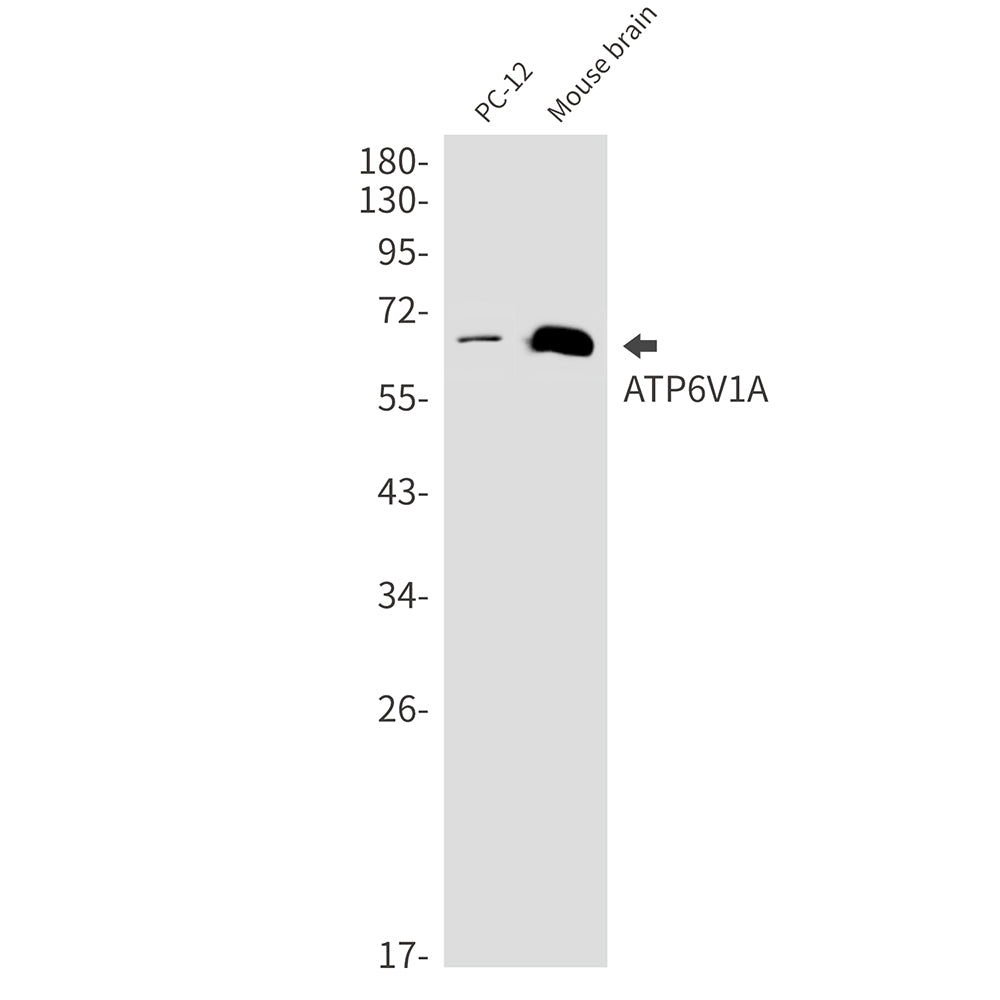 ATP6V1A Rabbit Monoclonal Antibody