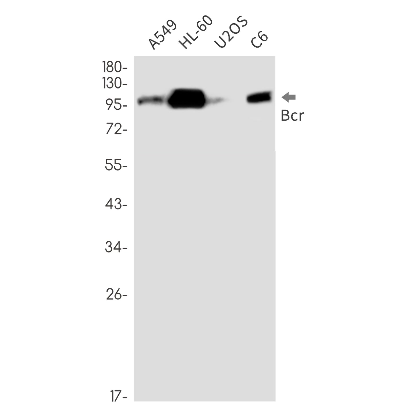 Bcr Rabbit Monoclonal Antibody