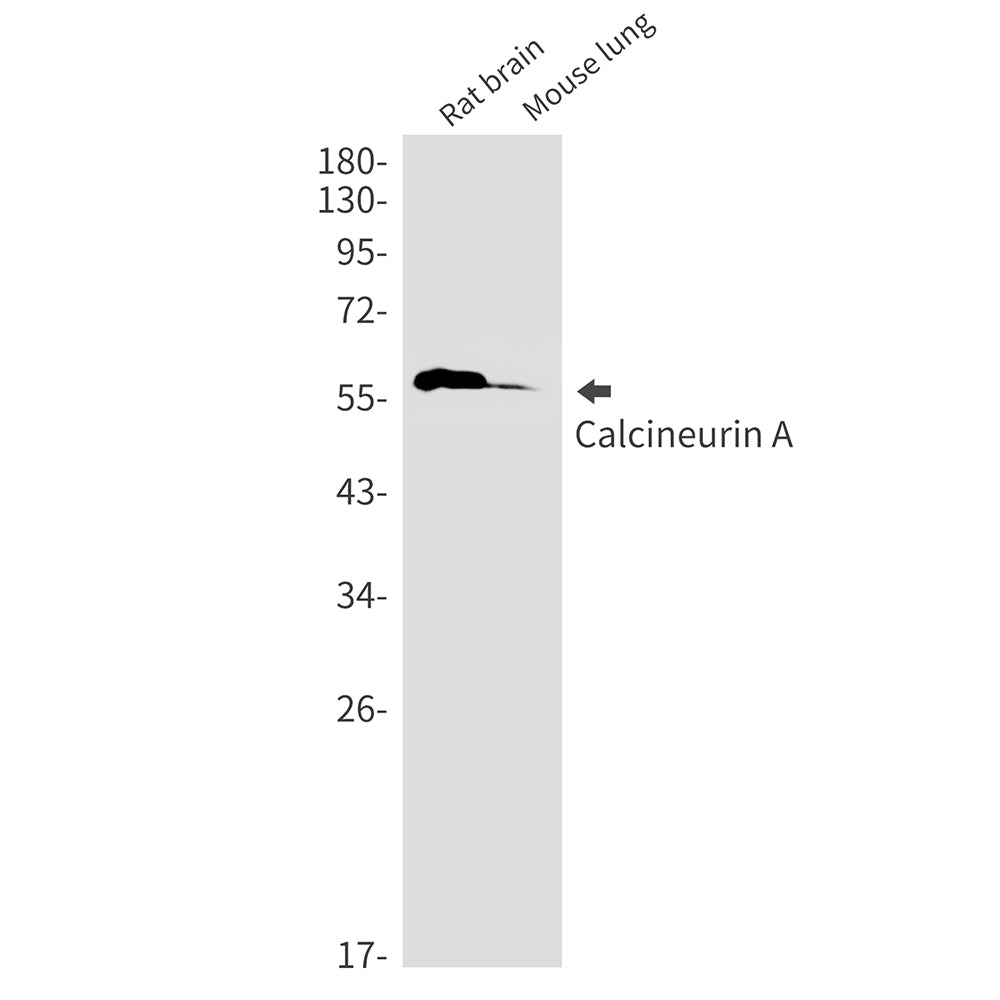 Calcineurin A Rabbit Monoclonal Antibody