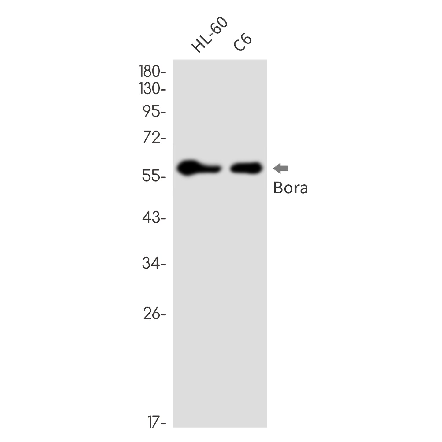 Caldesmon Rabbit Monoclonal Antibody